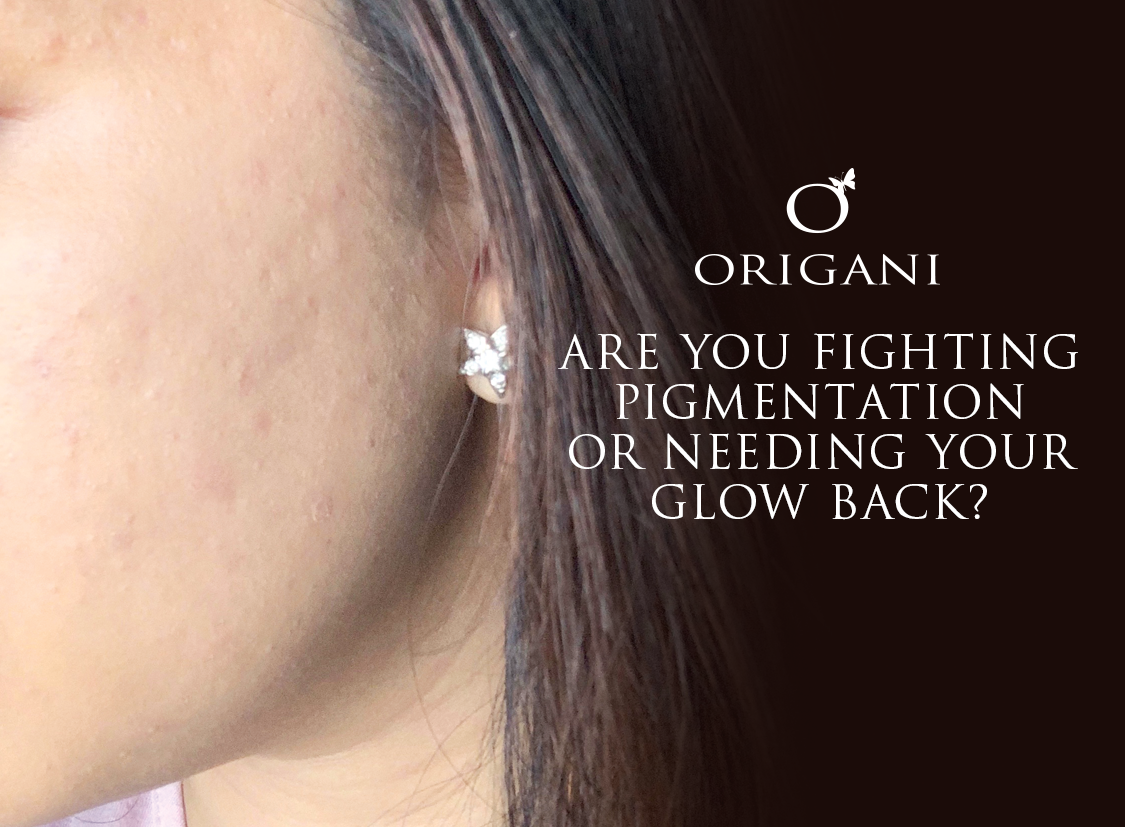 Are You Fighting Pigmentation Or Needing Your Glow Back?