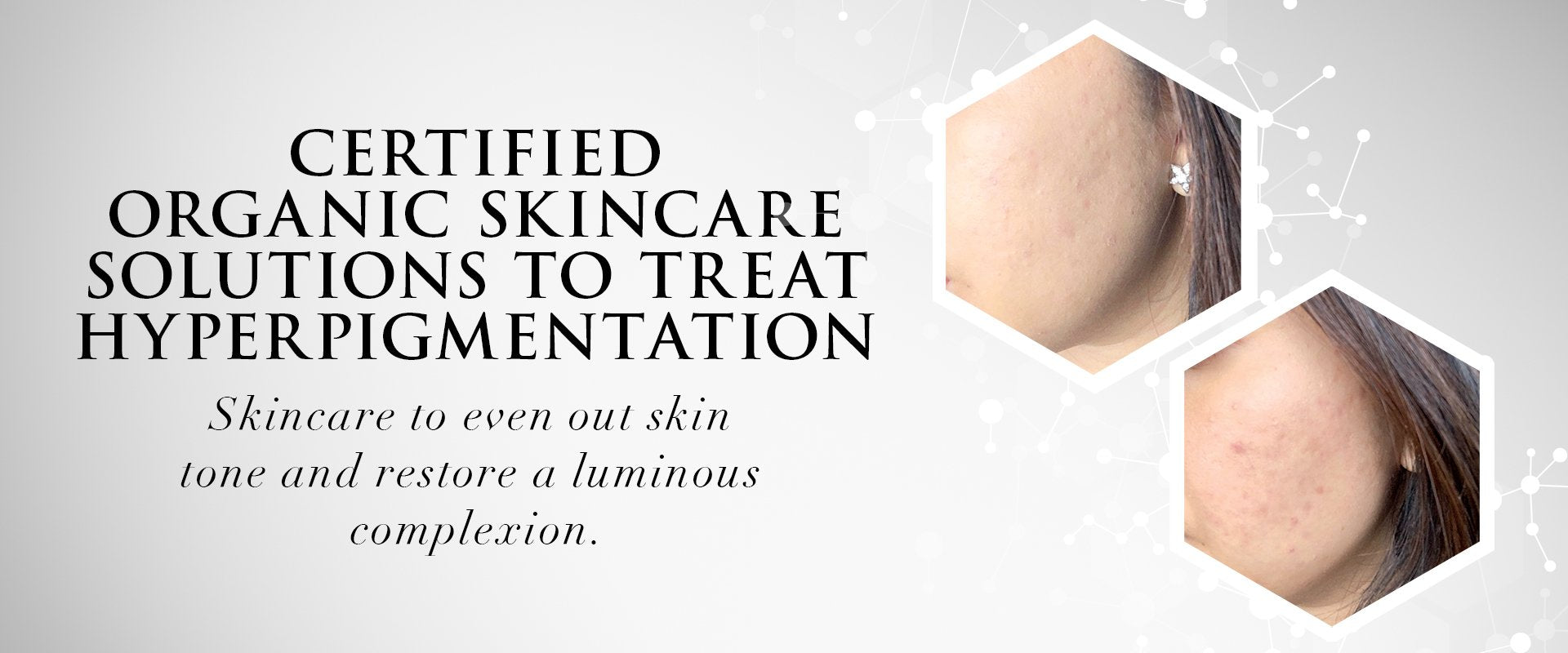 Pigmentation